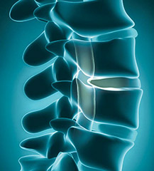 OSTEOwelt® SYNTHETIC BONE Graft